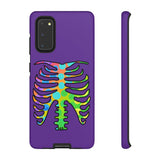 Load image into Gallery viewer, Bones phone Cases